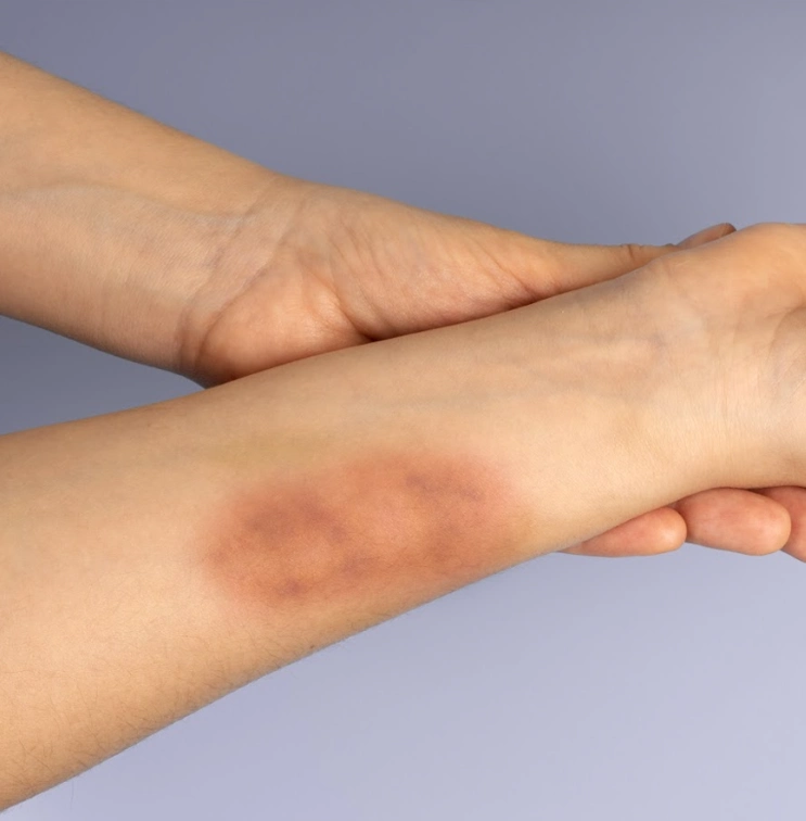 Trusted Assault Attorney in Texas